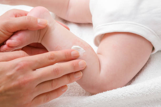 Higiene y cuidado para piel atópicas, secas y muy sensibles